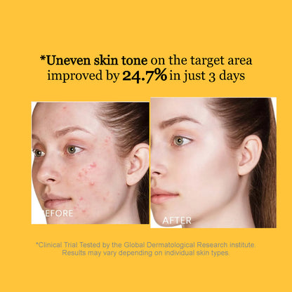 TrueNature® - Turmeric & Kojic Acid Brightening Facial Cleanser